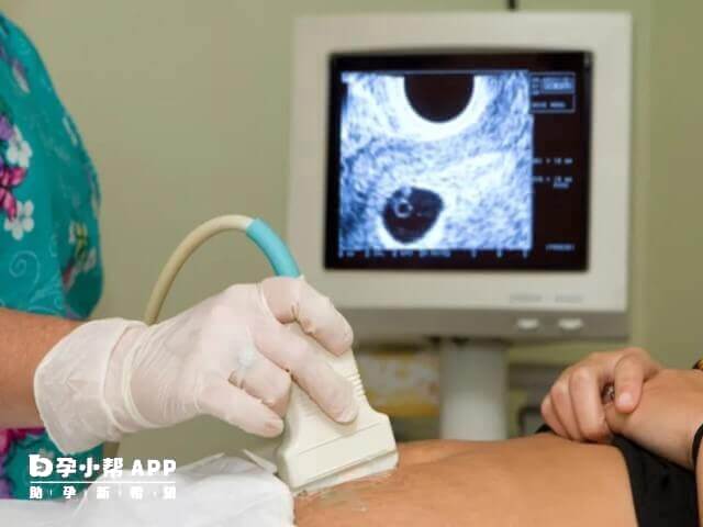 排卵前期卵泡監測卵巢無回聲是優質卵泡