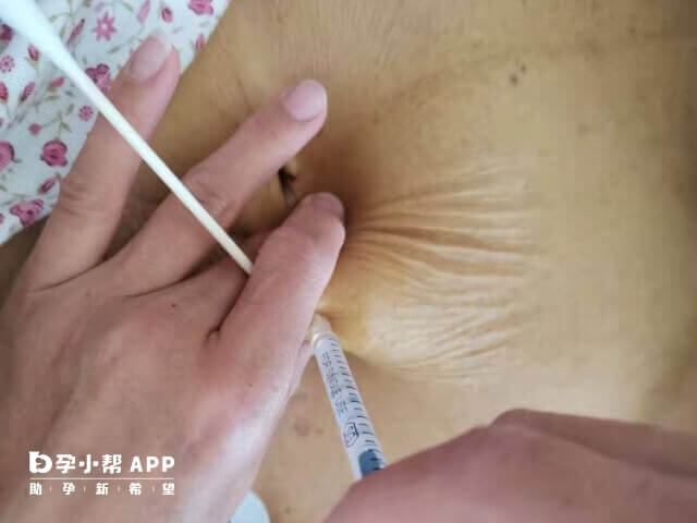 試管長方案直接打果納芬