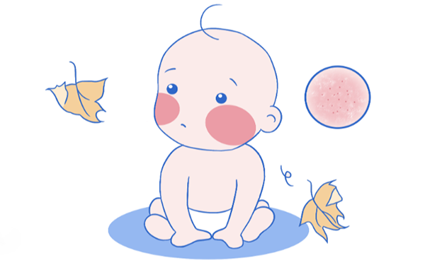 嬰寶溼疹膏不建議塗抹在腋下顏面