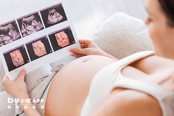 無創DNA如何進行檢測