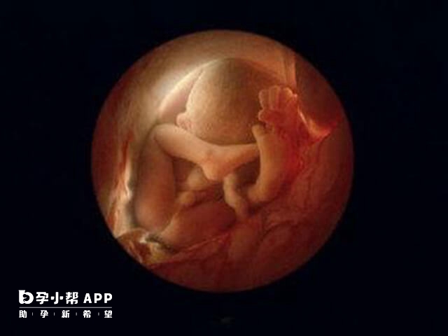 唐篩看性別的準確性