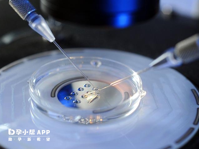 試管需要取精取卵進行體外受精