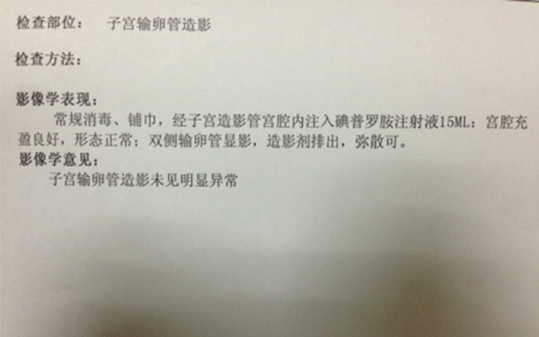 輸卵管造影當天是可以拿到結果的