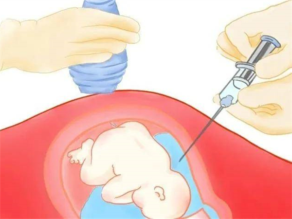羊水穿刺2000和6000检查项目不同