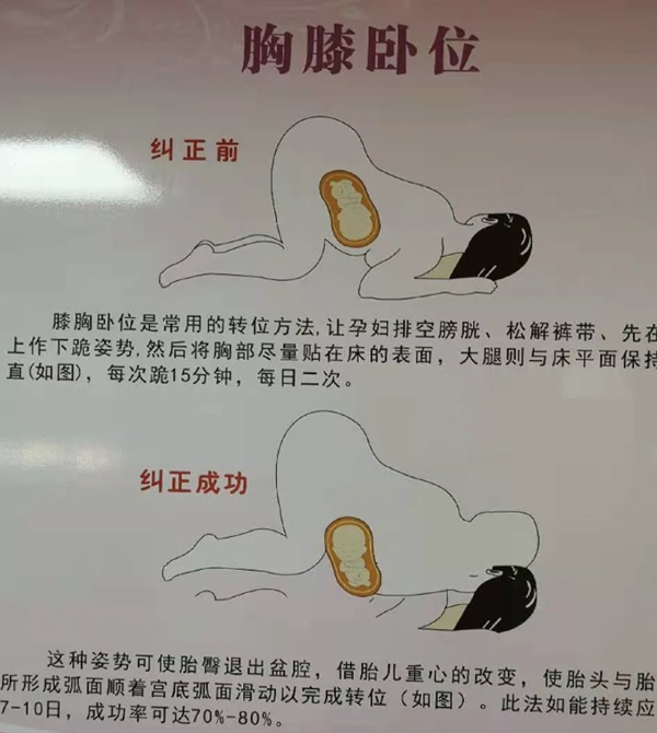 膝胸臥位的圖解