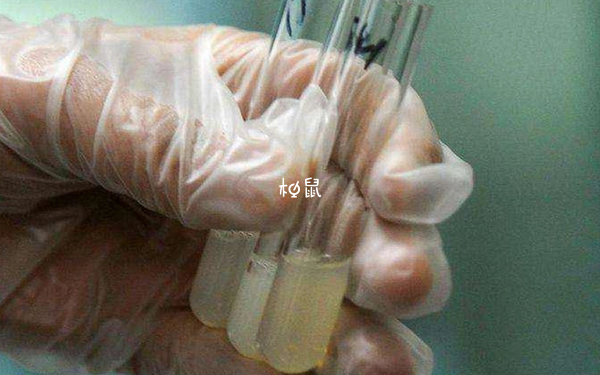 男士尿酸高可以進行試管取精