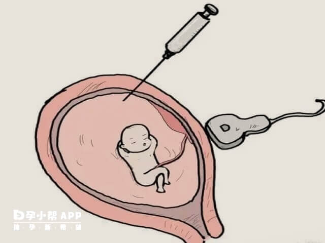 羊水穿刺能是不能夠查出胎兒智力低下的