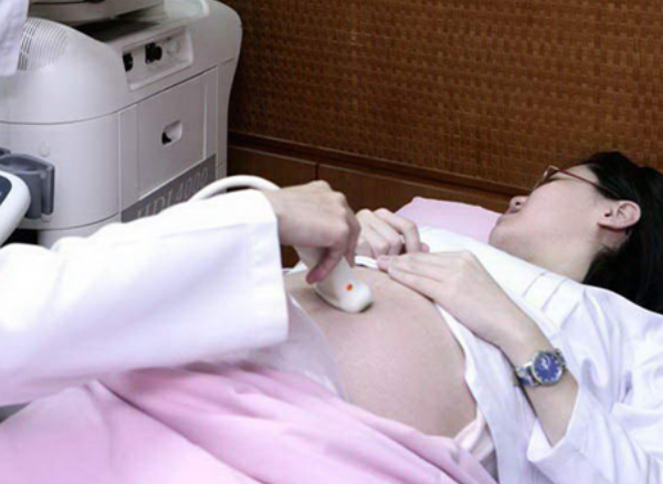 唐篩mom2.33是正常的