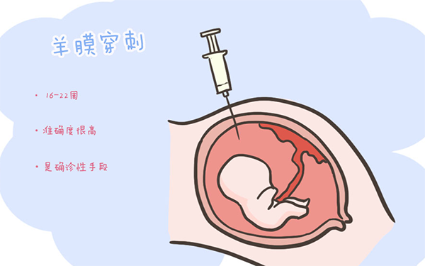 北医三院做羊水穿刺最佳时间是孕16-22周