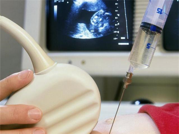 做羊水穿刺可能導致宮內感染