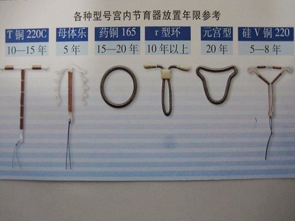 各类节育环放置年限参考