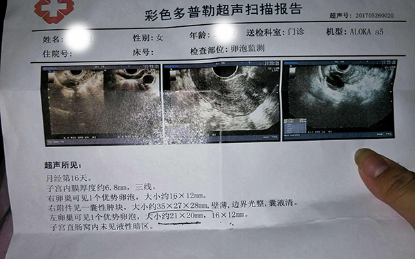 三個優勢卵泡建議放棄是怕傷害身體