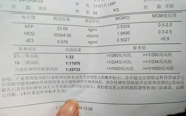 唐氏篩查無法分辨胎兒性別