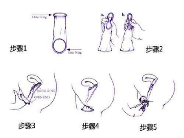 女用避孕藥膜使用圖解