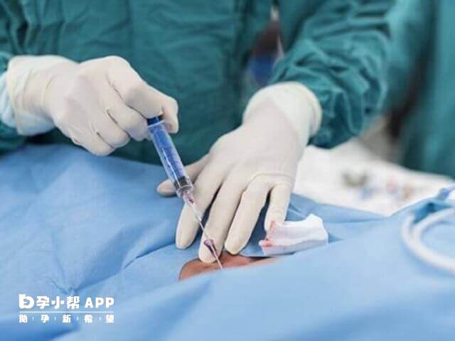 怕痛的人做宮腔鏡檢查需要全麻