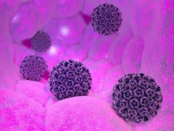 宮頸HPV感染但TCT正常可以做試管