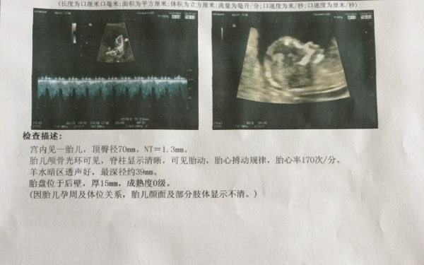 輕度的雌二醇下降是正常情況