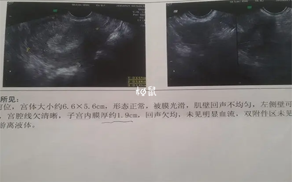 子宫内膜移植前达标