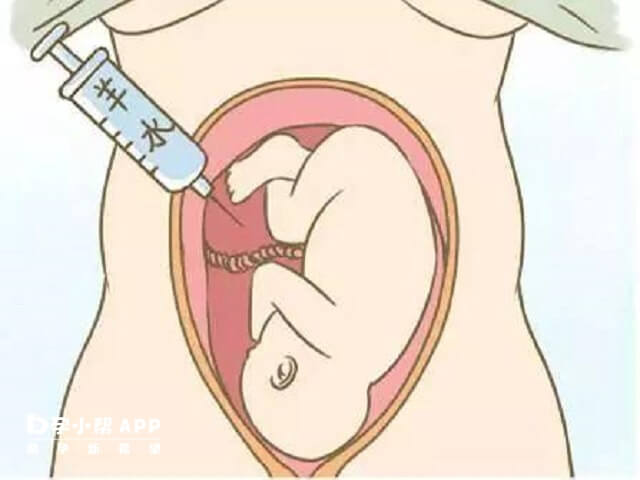 絨毛穿刺一般不會被誤診