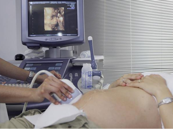 胎兒股骨短跟染色體有關係