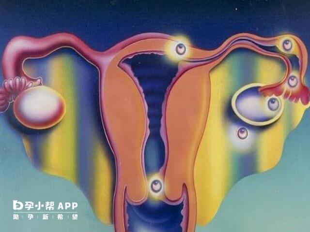 B超檢查能排除宮外孕