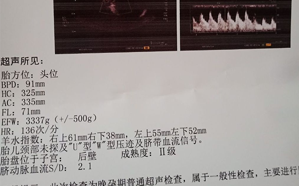 羊水指數與孕周按照正常範圍看