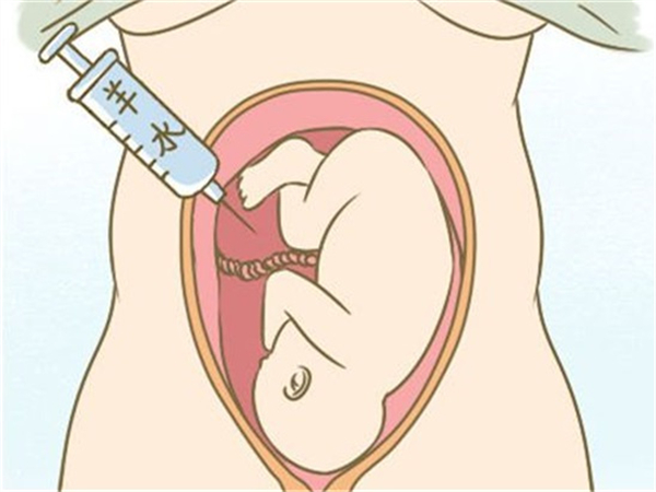 夫妻没有染色体疾病羊水穿刺易翻盘